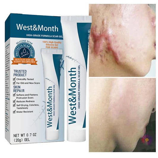 Herbal Scar Removal Cream Gel Repaire Pock Mark Burn Surgical Scar Cesarean Scar Stretch Mark Treatment Cream Smooth Skin Care